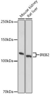 Western Blot: IRP2 Antibody [NBP3-03393] - Western blot analysis of extracts of various cell lines, using IRP2 antibody (NBP3-03393) at 1:1000 dilution. Secondary antibody: HRP Goat Anti-Rabbit IgG (H+L) at 1:10000 dilution. Lysates/proteins: 25ug per lane. Blocking buffer: 3% nonfat dry milk in TBST. Detection: ECL Basic Kit. Exposure time: 3s.